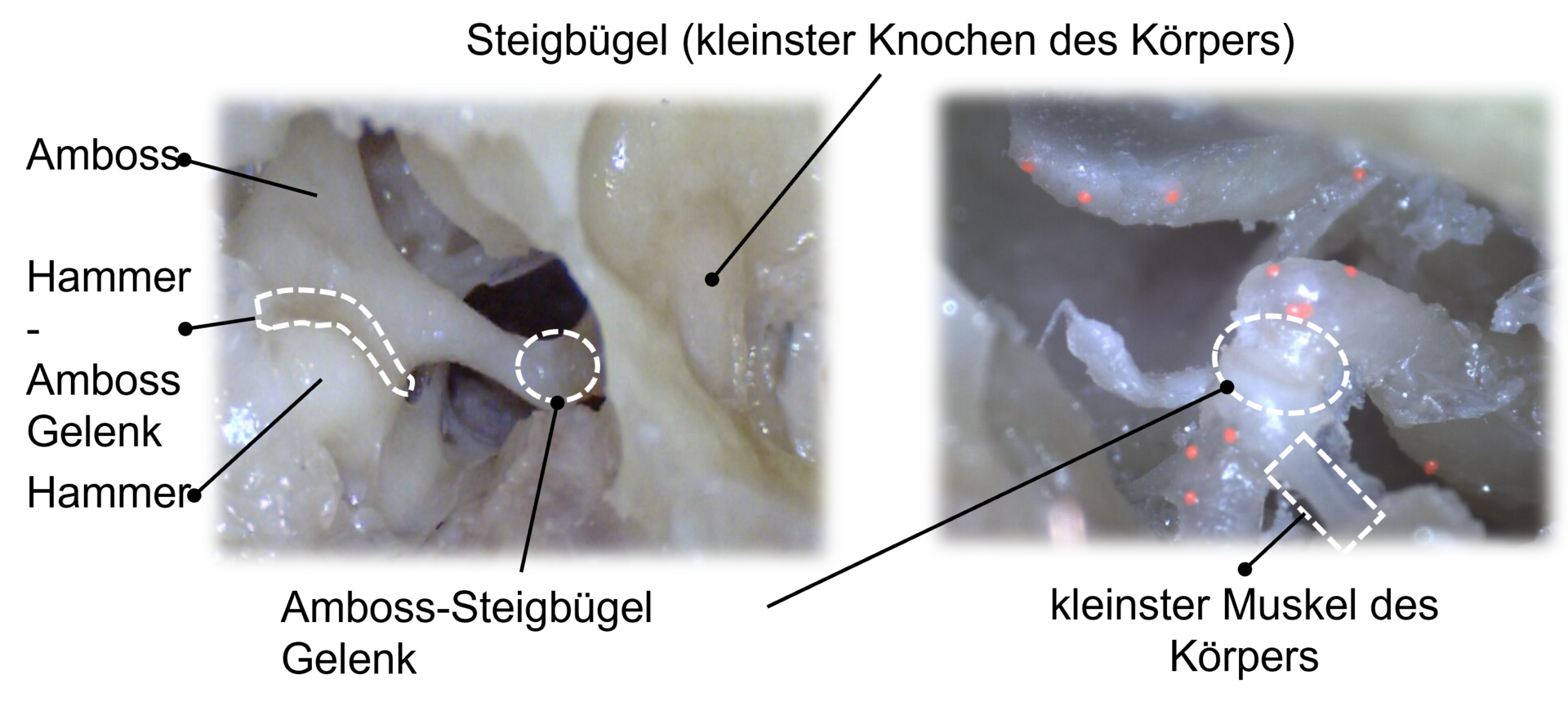Der Steigbügel ist der kleinste Knochen des Körpers